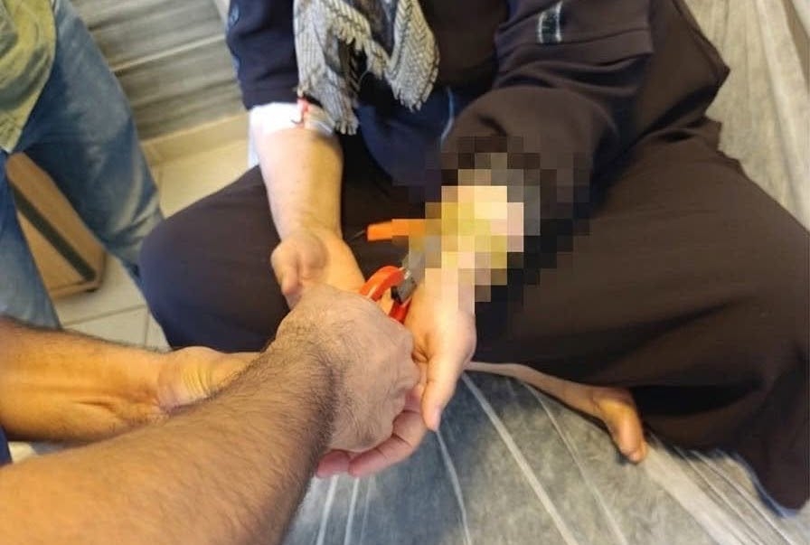 Bileziği Çıkarmak İçin İtfaiye Seferber Oldu
